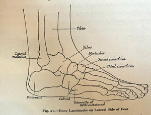 Why Your Feet Hurt — And Why the Answer Is Usually Your Shoes